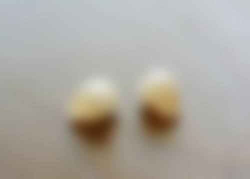 香港 澳门哪个牙科更好 价钱范围(HKD)!对比香港同深圳口岸