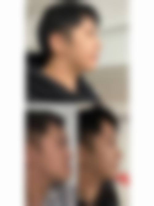 澳门牙科vs香港牙科:边个性价比更高?(附真实实例)