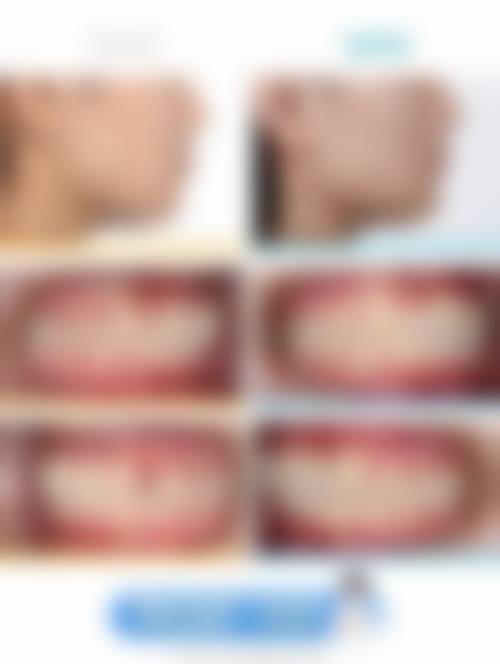 深圳合心口腔诊所口碑好不好?患者真实评价: