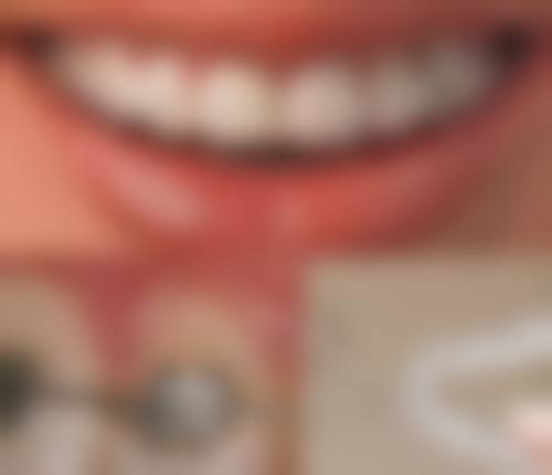 二十多岁做牙齿矫正,这些注意事项要牢记!