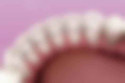 二十多岁做牙齿矫正晚不晚?一点都不晚!