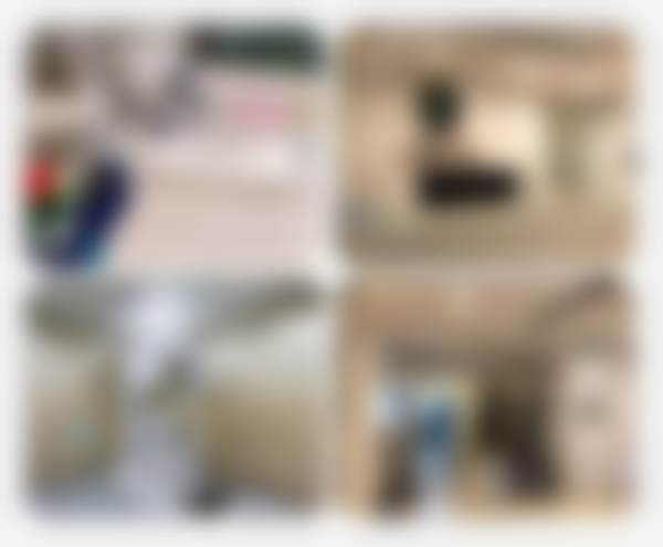 十、相关科普内容推荐:3D超薄瓷贴面技术详解