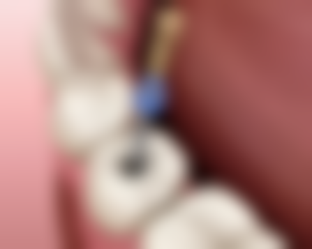 拓展延伸：深圳睇牙常見問題解答