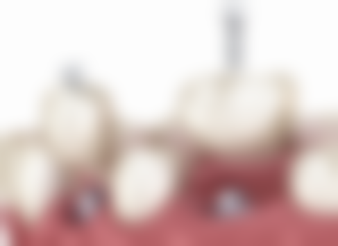 理性提醒:香港人北上整牙必知!