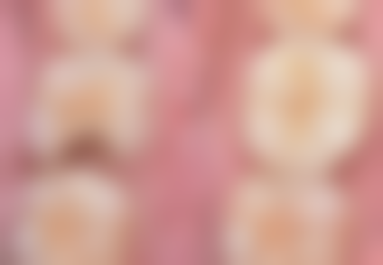 1. 連續缺3 - 4隻牙,骨量唔夠嘅姊妹