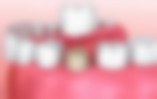 格倫菲爾口腔价目表2026｜香港人深圳睇牙慳錢50%攻略！西九高鐵20分鐘直達排名榜1