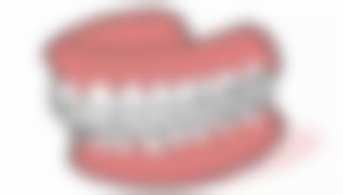 呼和浩特天牙口腔门诊部其他口腔项目价格明细:拔牙、牙周、镶牙全覆盖