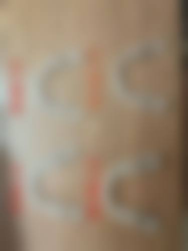 種植牙收費2026大公開！單顆770起/半口1.3w+全口4w起，價目表+收費項目一次睇清