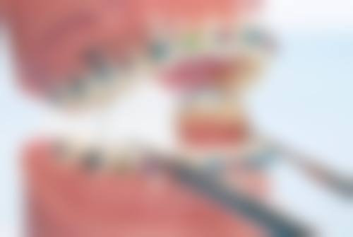 香港 格倫菲爾洗牙價錢 點預約?3步搞掂唔使等!