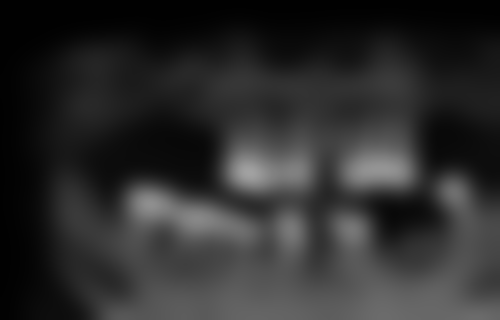 香港vs深圳口岸All-on-4植牙價格對比:邊度更抵?