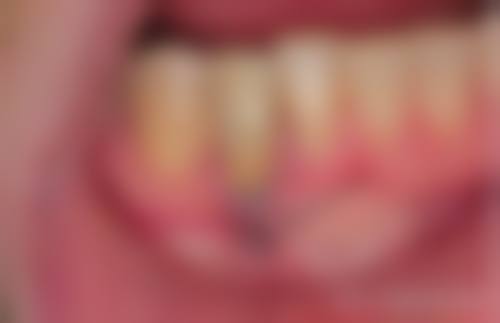 香港 澳门牙医哪家好 诊所拣选要点:医生资质/位置/设备要睇清