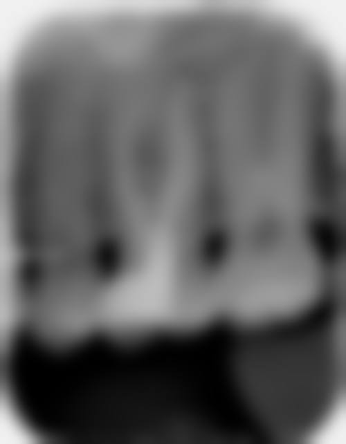 香港 澳门根管治疗哪家好 诊所拣选3大关键要点