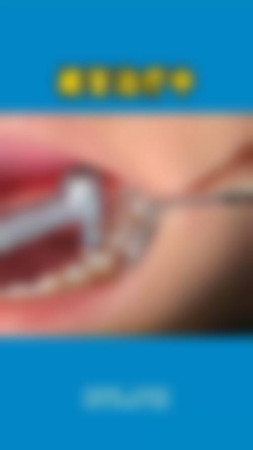 拓展延伸:根管治疗真相 + 关键选择点