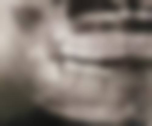 五、看牙贵不贵？深圳市坪山区人民医院收费正规透明吗？