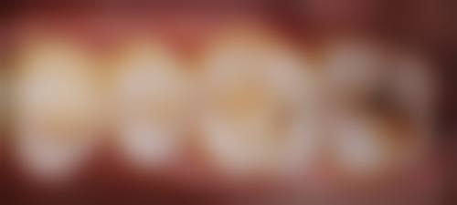 五、关键信息：北京大学人民医院口腔科电话号码与地址详情