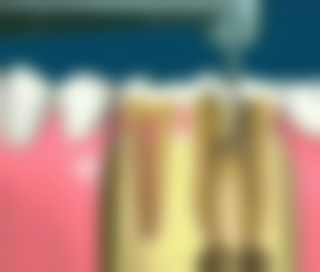 澳门根管治疗哪家好？2026精选5大专业牙医诊所！附收费/评价/地址全攻略