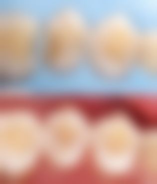 四、从补牙到种牙，技术设备能“一站搞定”吗？