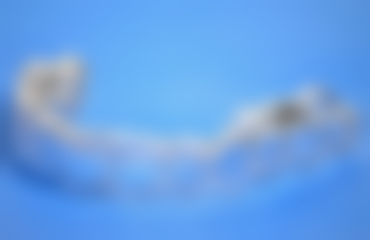 韩国种植牙价格亲民的背后