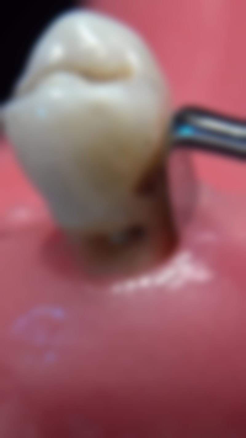 五、陈雅云医生口碑和评价