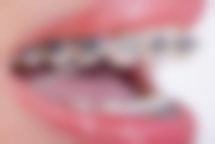 浙江温州乐清何祖成口腔价格表/收费价格一览表