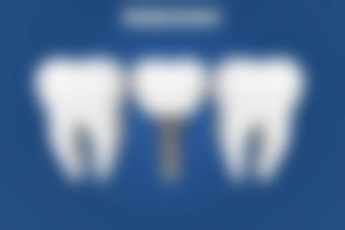 香港 珠海拱北牙科醫院電話：交通攻略（更快30分鐘到達）