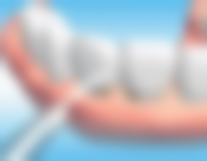 拓展延伸：香港人北上整牙常見問題解答