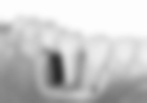 香港 微創植牙香港 VS 深圳口岸：價錢差幾多？邊個更抵？