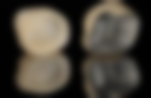 香港 香港牙醫推薦 網上預約免排隊攻略：3步搞掂！