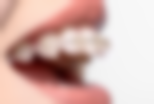 总结：选择添悦口腔刘学敏主事，安心开启矫正之旅