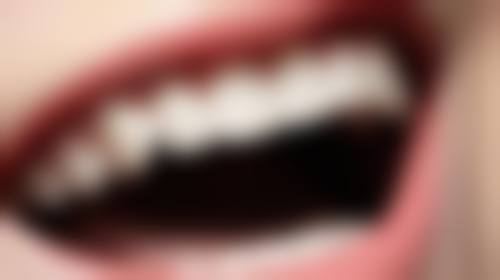 拓展延伸：澳门睇牙必知真相+避坑指南