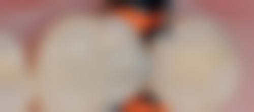 香港 澳门哪里有牙医诊所 诊所拣选要点：3步避坑指南