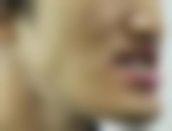 香港 澳门看牙科医院多少钱 诊所拣选要点