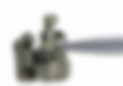 怎么判断我是否适合地包天矫正项目？