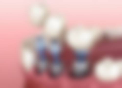 2026港人推3間平靚正！拱北5分鐘種牙正畸齊備