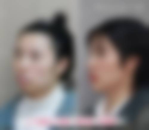 香港 珠海拱北牙科哪里好 价钱范围（HKD）大公开