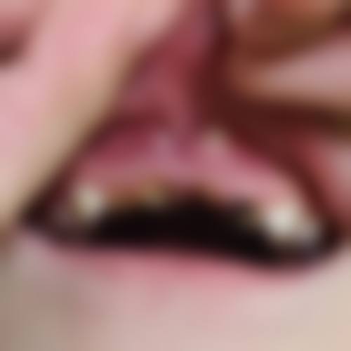 香港 蛀牙要掛哪一科？ 常見誤區（千祈唔好犯！）