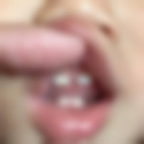 香港 蛀牙要掛哪一科？ 價錢範圍（HKD）+ 深圳口岸對比