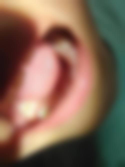 香港 蛀牙要掛哪一科？ 適合邊類人群