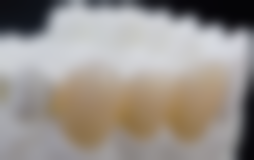 香港 vs 深圳口岸牙科价格对比：边度睇牙更抵？