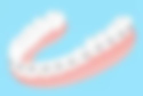 拓展延伸：賽馬會牙科服務真相+避坑指南