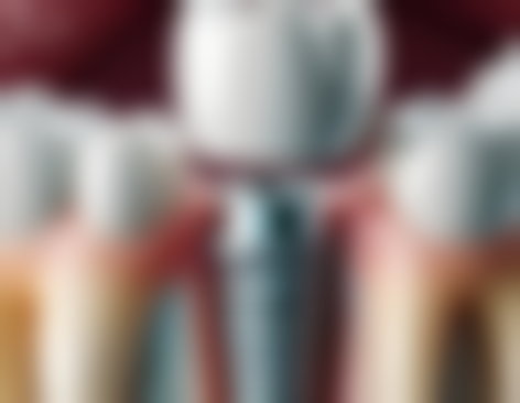 香港 澳门牙科更厉害三个医院：价钱对比！香港vs澳门vs深圳口岸，边度更抵？