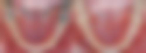 香港 澳门口腔医院哪家更好 2026口碑榜TOP5精选