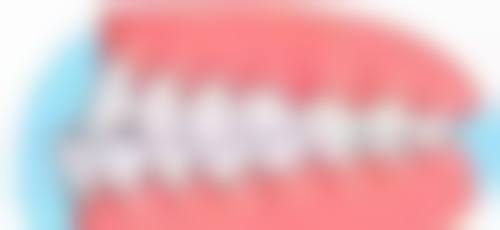 儿童牙齿矫正要拔牙吗所依赖的技术 / 材料，现实优势与限制并存