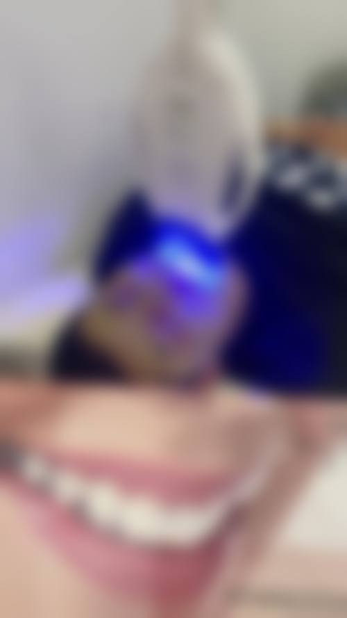 香港 澳门口腔医院哪家更好 项目真相:种牙/矫正常见Q&A