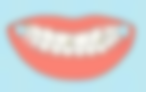 香港 澳門去拱北口岸牙科醫院：價錢差幾多？香港vs拱北真實對比