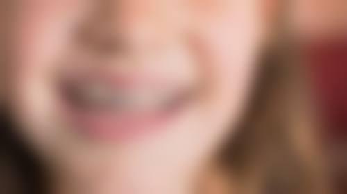 香港 香港大學深圳醫院口腔科收費 影響價錢嘅3大因素