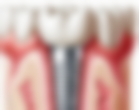 理性提醒：香港人北上睇牙必备常识