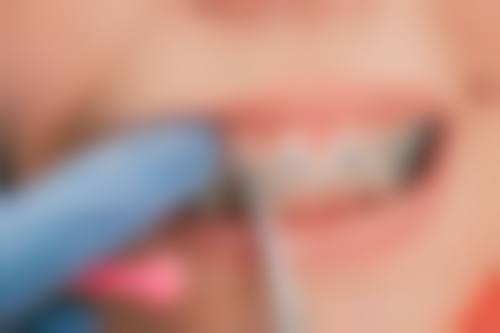 医生在儿童牙齿地包天矫正长期成效判断中的作用