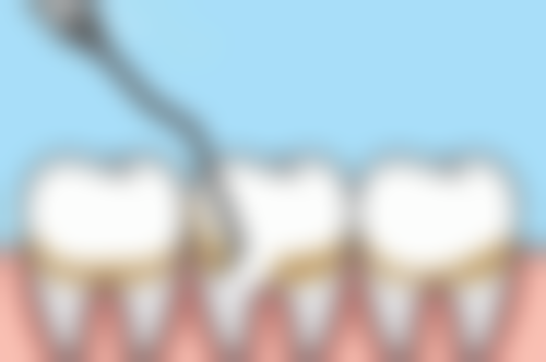 香港 香港大學深圳醫院牙科收費:邊類人群更啱去?