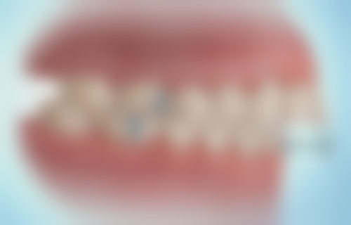 香港 香港大學深圳醫院牙科收費:點樣預約先至唔使等?